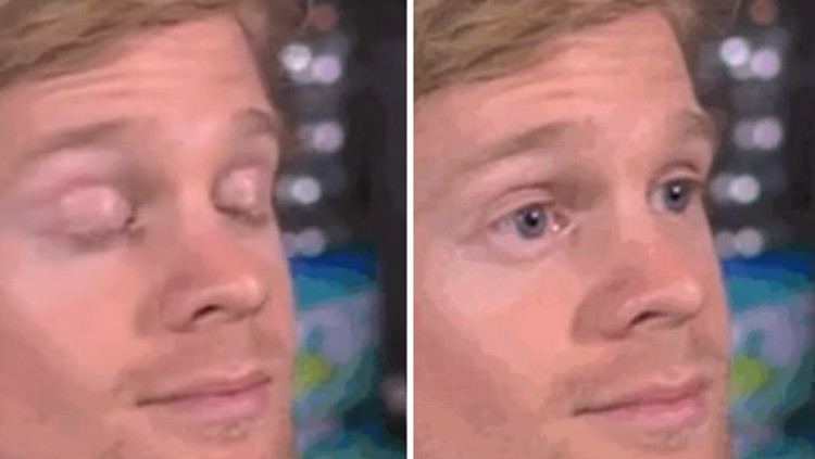 White-Guy-Blinking-GIF.jpg